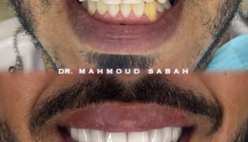 Dr.Mahmoud Sabah – Cosmetic Dentist