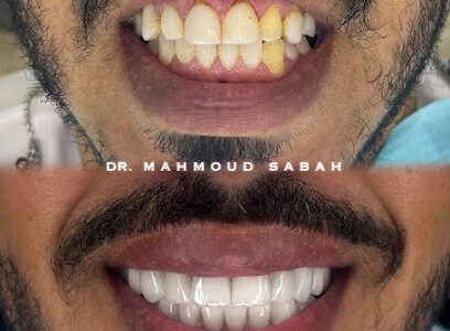 Dr.Mahmoud Sabah – Cosmetic Dentist