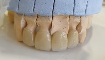 FRESHDENT DENTAL CLINIC