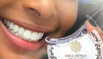 Smile Design Dental Clinic