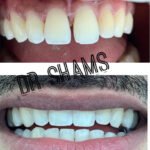Dr. Shams Tabrez – B.D.S, M.D.S. (Orthodontics), C-ICOI-(Implantology)