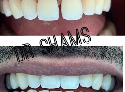 Dr. Shams Tabrez – B.D.S, M.D.S. (Orthodontics), C-ICOI-(Implantology)