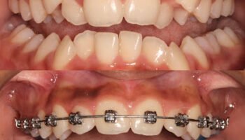 Dr Karan Kalra- Orthodontist (braces Specialist)