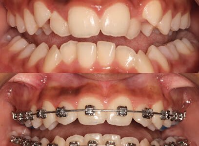 Dr Karan Kalra- Orthodontist (braces Specialist)