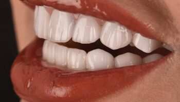 On.clinic dental center