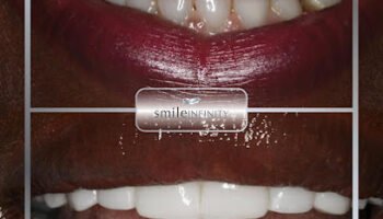 Smile Infinity Dubai