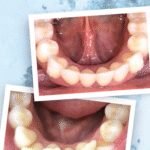 Proalign Smile Shop Dental Clinic