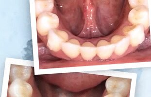 Proalign Smile Shop Dental Clinic