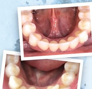 Proalign Smile Shop Dental Clinic