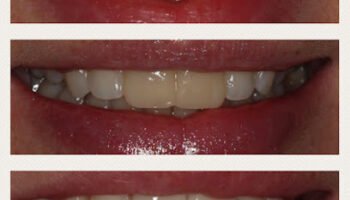 Dentamed Clinic Dubai