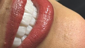 Smile Dental Center