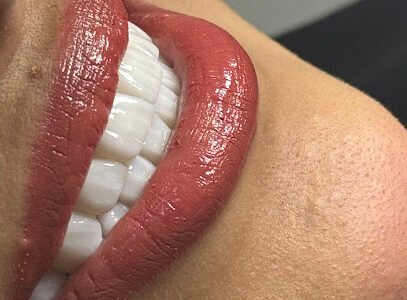 Smile Dental Center