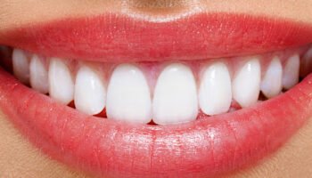 Al Najma Dental Clinic