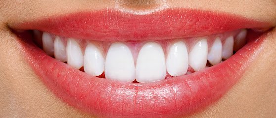 Al Najma Dental Clinic