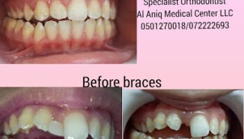 Al Aniq Dental Clinic