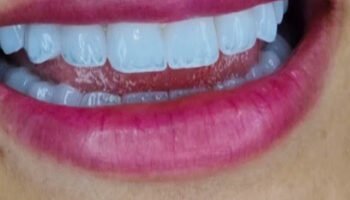 Dr. WADAH FALHOUT DENTAL CLINIC