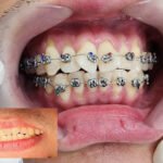 Altamayoz Dental Center Rak