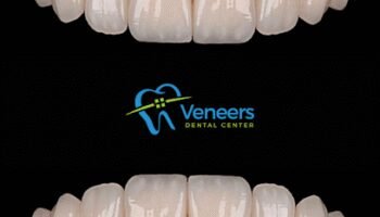 Veneers Dental Centre