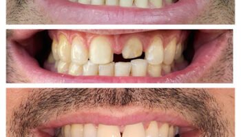 Ilham Dental Clinic