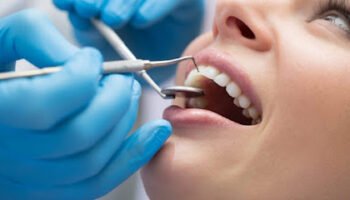 Teeth Cleaning, Teeth Filling, Extractions, TMJ Treatment Satwa Cosmocare