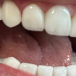 Dr Ossama Bazzi Dental Clinic