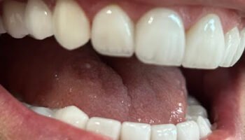 Dr Ossama Bazzi Dental Clinic