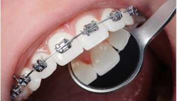 Sharjah Orthodontist -Dentist