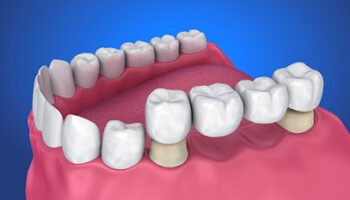 Dr. Thomas Dental Implant Clinic