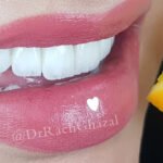 Dr. Racha Ghazal Cosmetic Dentistry Clinic