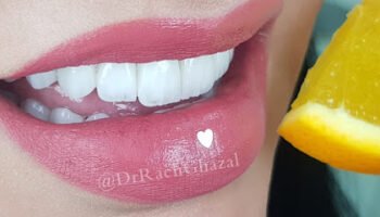 Dr. Racha Ghazal Cosmetic Dentistry Clinic