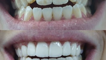 MUNICH DENTAL CLINIC Dubai