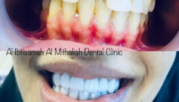 Alibtisamah almithaliah dental clinic