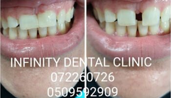 infinity dental clinic