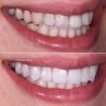 Emirates Dental – Cosmetic Dentistry & Invisalign Clinic Dubai