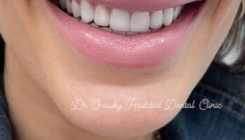 Dr. Chawky Haddad Dental Clinic